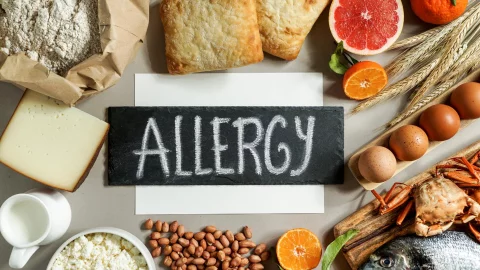 service-food-allergy